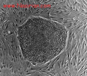 687px-Human_embryonic_stem_cell_colony_phase